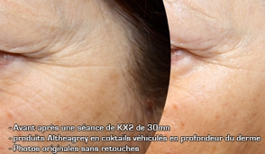 soins-kx2